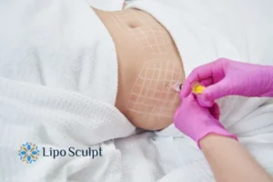 Are The Results From Aqualyx Permanent? 1 Do you want to know how long Aqualyx Richmond upon Thames results last?