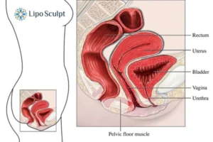 Treatment For A Leaky Bladder 2 How EM Chair treatment Richmond upon Thames can help Leaky bladder issues. Read more now!