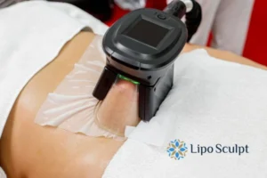 Does Fat Freezing At Home Work? 3 Fat freezing at home from Lipo Sculpt Richmond upon Thames