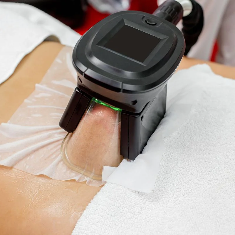 Fat Freezing treatment Richmond upon Thames